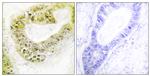 ZNF638 Antibody in Immunohistochemistry (Paraffin) (IHC (P))