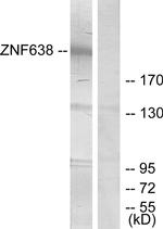 ZNF638 Antibody in Western Blot (WB)