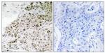 TAF13 Antibody in Immunohistochemistry (Paraffin) (IHC (P))