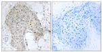 PPP1R2 Antibody in Immunohistochemistry (Paraffin) (IHC (P))