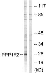 PPP1R2 Antibody in Western Blot (WB)