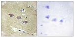 CaMKV Antibody in Immunohistochemistry (Paraffin) (IHC (P))