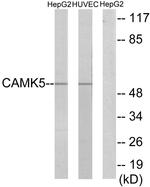 CaMKV Antibody in Western Blot (WB)