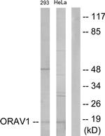 ORAOV1 Antibody in Western Blot (WB)