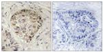 Phospho-CENTB1 (Ser554) Antibody in Immunohistochemistry (Paraffin) (IHC (P))