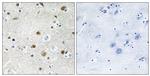 BRF1 Antibody in Immunohistochemistry (Paraffin) (IHC (P))