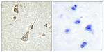 PCDH11Y Antibody in Immunohistochemistry (Paraffin) (IHC (P))