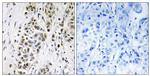 XRN2 Antibody in Immunohistochemistry (Paraffin) (IHC (P))