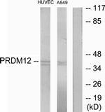 PRDM12 Antibody in Western Blot (WB)