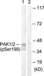 Phospho-TERT (Ser824) Antibody in Western Blot (WB)