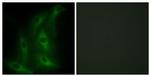 COL4A6 Antibody in Immunocytochemistry (ICC/IF)