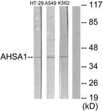 COL9A2 Antibody in Western Blot (WB)