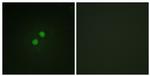 Phospho-NBS1 (Ser278) Antibody in Immunocytochemistry (ICC/IF)