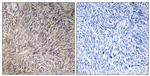 FGF22 Antibody in Immunohistochemistry (Paraffin) (IHC (P))