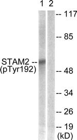 Phospho-STAM2 (Tyr192) Antibody in Western Blot (WB)