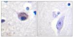 Phospho-VAV2 (Tyr142) Antibody in Immunohistochemistry (Paraffin) (IHC (P))