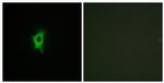 Galectin 2 Antibody in Immunocytochemistry (ICC/IF)