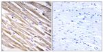 RPL3L Antibody in Immunohistochemistry (Paraffin) (IHC (P))