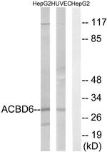 ACBD6 Antibody in Western Blot (WB)