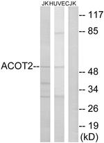 ACOT2 Antibody in Western Blot (WB)