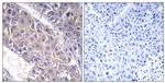 B4GALT3 Antibody in Immunohistochemistry (Paraffin) (IHC (P))