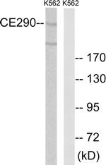 CEP290 Antibody in Western Blot (WB)