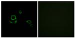 Factor XIII B Antibody in Immunocytochemistry (ICC/IF)