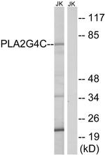 PLA2G4C Antibody in Western Blot (WB)