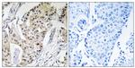 POLE4 Antibody in Immunohistochemistry (Paraffin) (IHC (P))