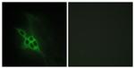 EphB1/EphB2/EphB3 Antibody in Immunocytochemistry (ICC/IF)