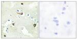 EphB1/EphB2/EphB3 Antibody in Immunohistochemistry (Paraffin) (IHC (P))