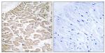 RRAD Antibody in Immunohistochemistry (Paraffin) (IHC (P))