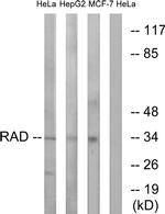 RRAD Antibody in Western Blot (WB)