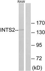 INTS2 Antibody in Western Blot (WB)