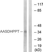 AASDHPPT Antibody in Western Blot (WB)