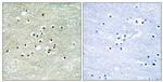 NPAS4 Antibody in Immunohistochemistry (Paraffin) (IHC (P))