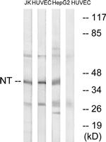 NTM Antibody in Western Blot (WB)