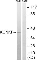 KCNK15 Antibody in Western Blot (WB)