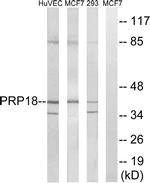 PRPF18 Antibody in Western Blot (WB)