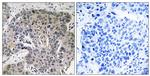 S100A3 Antibody in Immunohistochemistry (Paraffin) (IHC (P))