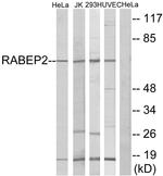 RABEP2 Antibody in Western Blot (WB)