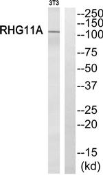 ARHGAP11A Antibody in Western Blot (WB)