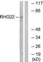 ARHGAP22 Antibody in Western Blot (WB)