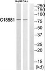 NEK5 Antibody in Western Blot (WB)