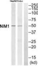 NIM1 Antibody in Western Blot (WB)