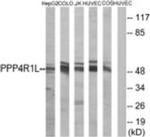 PPP4R1L Antibody in Western Blot (WB)