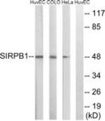 SIRPB1 Antibody in Western Blot (WB)