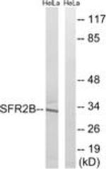 SRSF8 Antibody in Western Blot (WB)