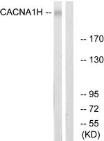 CaV3.2 Antibody in Western Blot (WB)