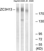 ZC3H13 Antibody in Western Blot (WB)